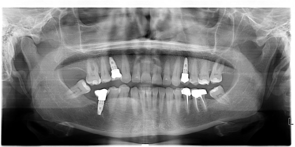 OPT Instrumentarium OP30 - Prodotto - OPT Instrumentarium OP30 - Dental ...